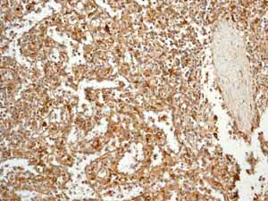 Immunohistochemistry (Formalin/PFA-fixed paraffin-embedded sections) - Anti-C1QB antibody [EPR2981] - BSA and Azide free (AB247575)