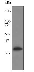 Western blot - Anti-C1QB antibody [EPR2981] - BSA and Azide free (AB247575)