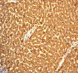 Immunohistochemistry (Formalin/PFA-fixed paraffin-embedded sections) - Anti-C1QC antibody [EPR2984Y] (AB75756)