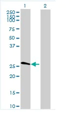 Western blot - Anti-C1QL1 antibody (AB68528)