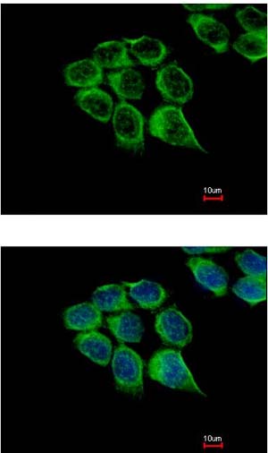 Immunocytochemistry/ Immunofluorescence - Anti-C1r antibody (AB155060), expandable thumbnail