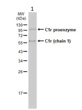 Western blot - Anti-C1r antibody (AB155060)