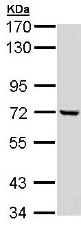 Western blot - Anti-C1r antibody (AB155060), expandable thumbnail