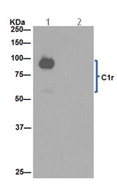 Immunoprecipitation - Anti-C1r antibody [EPR14914] - BSA and Azide free (AB251042), expandable thumbnail