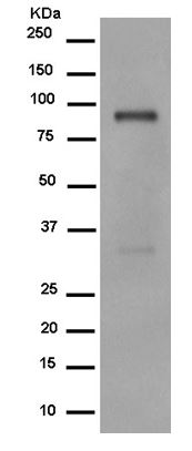 Western blot - Anti-C1r antibody [EPR14915] (AB185212), expandable thumbnail