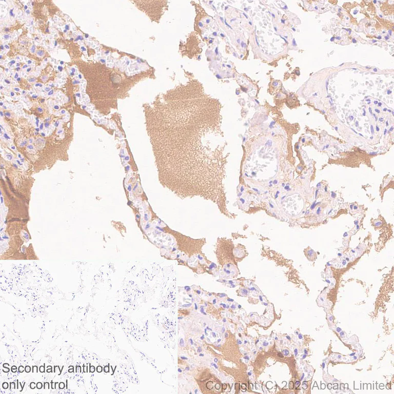 Immunohistochemistry (Formalin/PFA-fixed paraffin-embedded sections) - Anti-C1r antibody [EPR28027-35] - BSA and Azide free (AB324109)