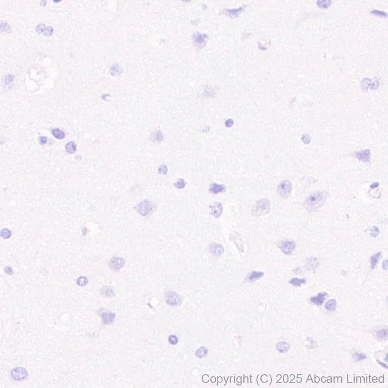 Immunohistochemistry (Formalin/PFA-fixed paraffin-embedded sections) - Anti-C1r antibody [EPR28027-35] - BSA and Azide free (AB324109)