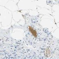 Immunohistochemistry (Formalin/PFA-fixed paraffin-embedded sections) - Anti-C1s antibody [9] (AB39551)