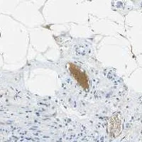 Immunohistochemistry (Formalin/PFA-fixed paraffin-embedded sections) - Anti-C1s antibody [9] (AB39551)