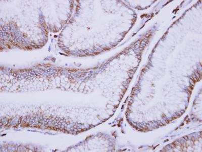 Immunohistochemistry (Formalin/PFA-fixed paraffin-embedded sections) - Anti-C1s antibody (AB155270), expandable thumbnail