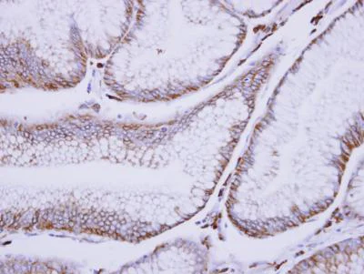 Immunohistochemistry (Formalin/PFA-fixed paraffin-embedded sections) - Anti-C1s antibody (AB155270)