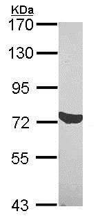 Western blot - Anti-C1s antibody (AB155270), expandable thumbnail