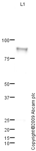 Western blot - Anti-C1s antibody (AB87986), expandable thumbnail