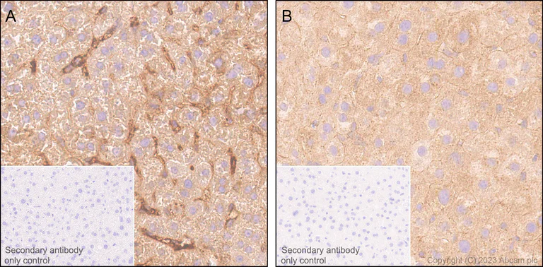 Immunohistochemistry (Formalin/PFA-fixed paraffin-embedded sections) - Anti-C1s antibody [EPR28071-53] (AB313883)
