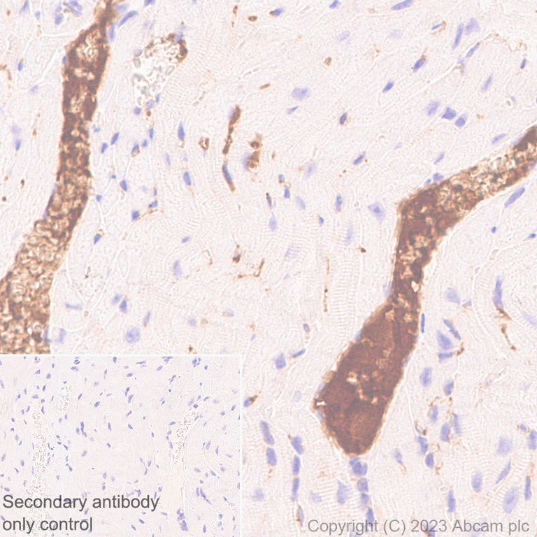 Immunohistochemistry (Formalin/PFA-fixed paraffin-embedded sections) - Anti-C1s antibody [EPR28071-53] (AB313883)