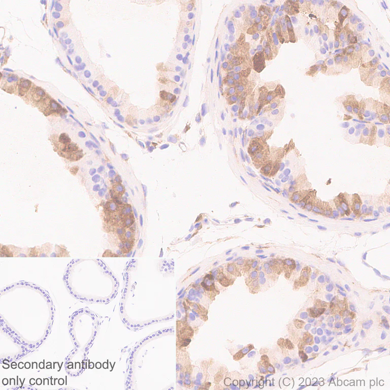 Immunohistochemistry (Formalin/PFA-fixed paraffin-embedded sections) - Anti-C1s antibody [EPR28071-53] - BSA and Azide free (AB313884)