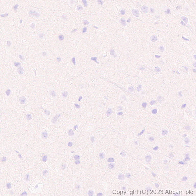 Immunohistochemistry (Formalin/PFA-fixed paraffin-embedded sections) - Anti-C1s antibody [EPR28071-53] - BSA and Azide free (AB313884)