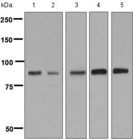Western blot - Anti-C1s antibody [EPR9066(B)] (AB134943)