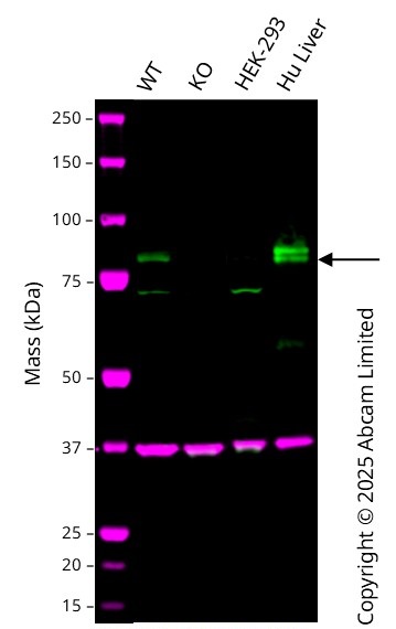Western blot - Anti-C1s antibody [EPR9066(B)] (AB134943)