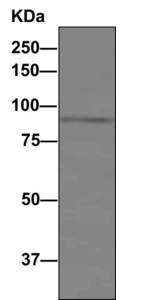 Immunoprecipitation - Anti-C1s antibody [EPR9066(B)] - BSA and Azide free (AB248746), expandable thumbnail