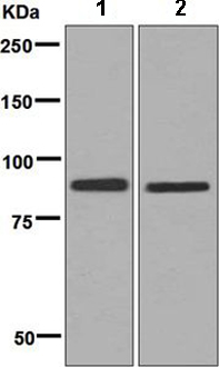 Western blot - Anti-C1s antibody [EPR9067(B)] (AB134928)