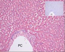 Immunohistochemistry (Formalin/PFA-fixed paraffin-embedded sections) - Anti-C1s antibody [M81] (AB81707)