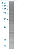 SDS-PAGE - C1s overexpression 293T lysate (whole cell) (AB94098)