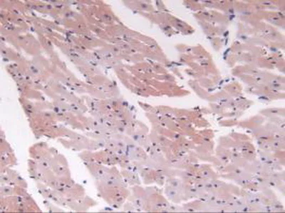 Immunohistochemistry (Formalin/PFA-fixed paraffin-embedded sections) - Anti-C2 antibody (AB231651)