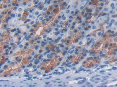 Immunohistochemistry (Formalin/PFA-fixed paraffin-embedded sections) - Anti-C2 antibody (AB231651)