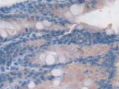 Immunohistochemistry (Formalin/PFA-fixed paraffin-embedded sections) - Anti-C2 antibody (AB231651)