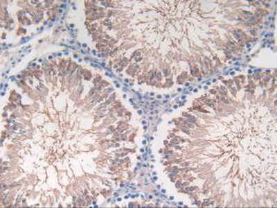 Immunohistochemistry (Formalin/PFA-fixed paraffin-embedded sections) - Anti-C2 antibody (AB231651)