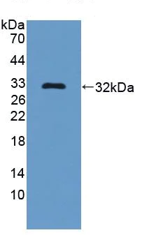 Western blot - Anti-C2 antibody (AB231651)