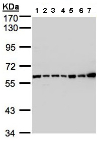 Western blot - Anti-C2 antibody (AB97461)