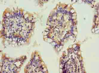 Immunohistochemistry (Formalin/PFA-fixed paraffin-embedded sections) - Anti-C20orf111 antibody (AB235334)