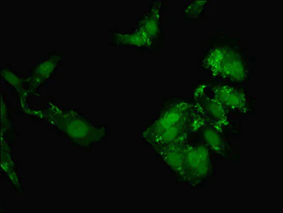Immunocytochemistry/ Immunofluorescence - Anti-C20orf112/NOL4L antibody (AB237758)