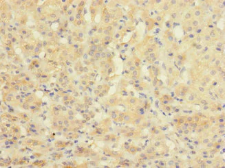 Immunohistochemistry (Formalin/PFA-fixed paraffin-embedded sections) - Anti-C20orf112/NOL4L antibody (AB237758)