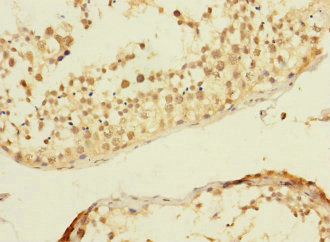 Immunohistochemistry (Formalin/PFA-fixed paraffin-embedded sections) - Anti-C20orf112/NOL4L antibody (AB237758)