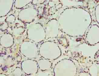Immunohistochemistry (Formalin/PFA-fixed paraffin-embedded sections) - Anti-C20orf112/NOL4L antibody (AB237758)