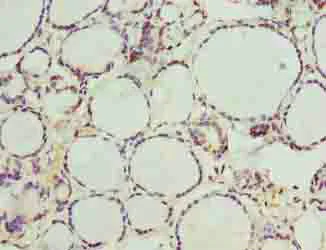 Immunohistochemistry (Formalin/PFA-fixed paraffin-embedded sections) - Anti-C20orf112/NOL4L antibody (AB237758)