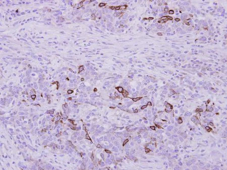 Immunohistochemistry (Formalin/PFA-fixed paraffin-embedded sections) - Anti-C20orf19 antibody (AB154723)