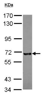 Western blot - Anti-C20orf19 antibody (AB154723)