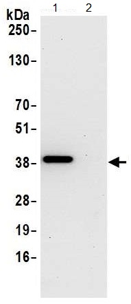Immunoprecipitation - Anti-C20orf77 antibody (AB137246)