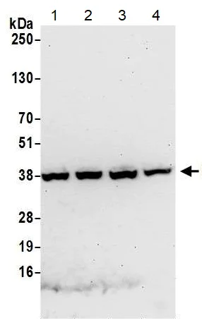 Western blot - Anti-C20orf77 antibody (AB137246)