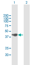 Western blot - Anti-C21orf2 antibody (AB167351)