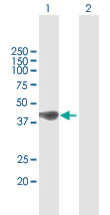 Western blot - Anti-C21orf2 antibody (AB167351)