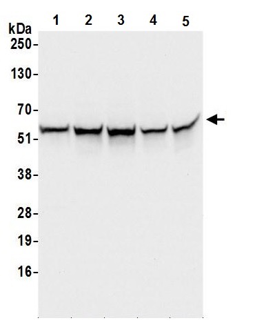 Western blot - Anti-C22orf28 antibody (AB241398), expandable thumbnail