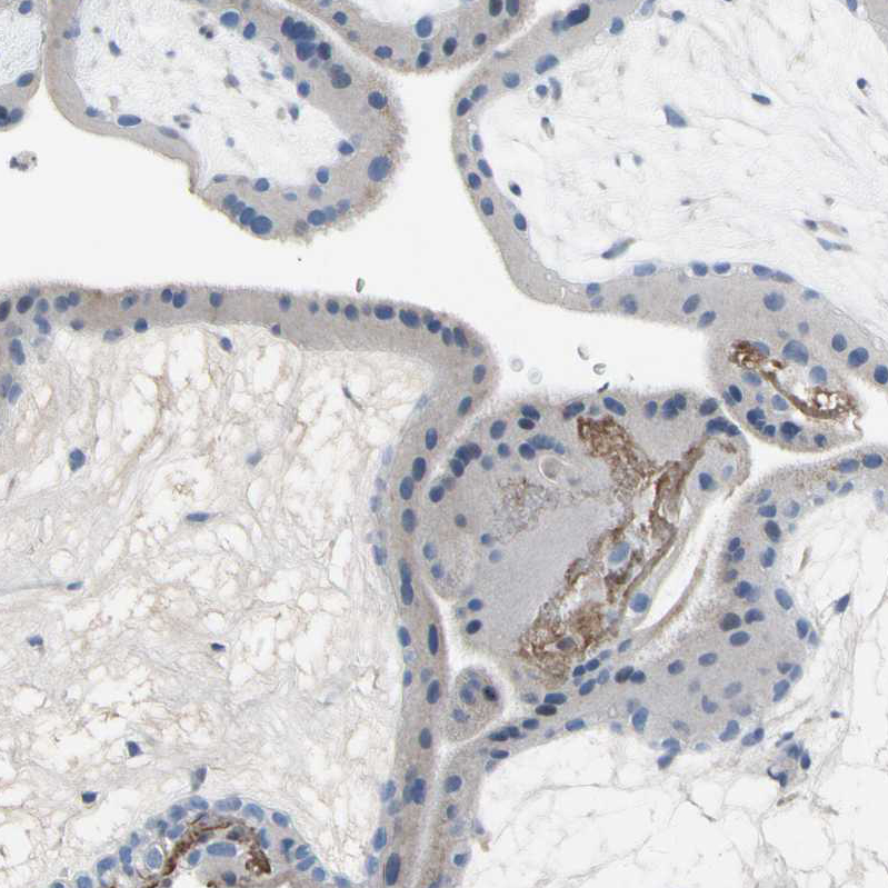 Immunohistochemistry (Formalin/PFA-fixed paraffin-embedded sections) - Anti-C2orf40/ECRG4 antibody (AB224077)