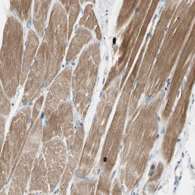 Immunohistochemistry (Formalin/PFA-fixed paraffin-embedded sections) - Anti-C2orf40/ECRG4 antibody (AB224077)