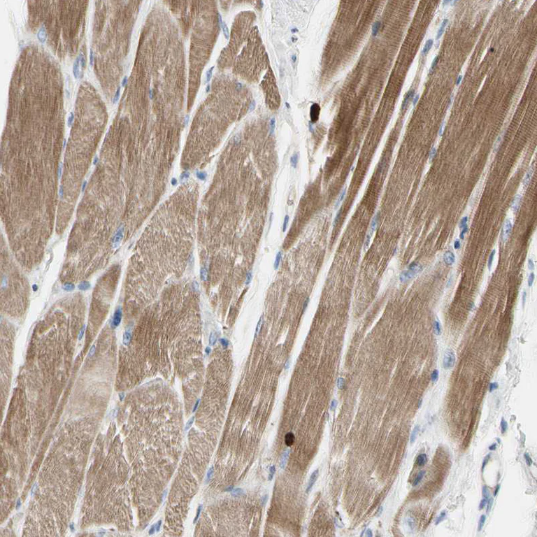 Immunohistochemistry (Formalin/PFA-fixed paraffin-embedded sections) - Anti-C2orf40/ECRG4 antibody (AB224077)