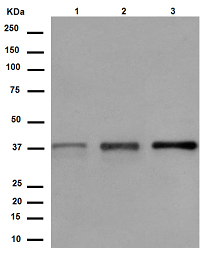 Western blot - Anti-C2orf69 antibody [EPR13713] (AB188870), expandable thumbnail